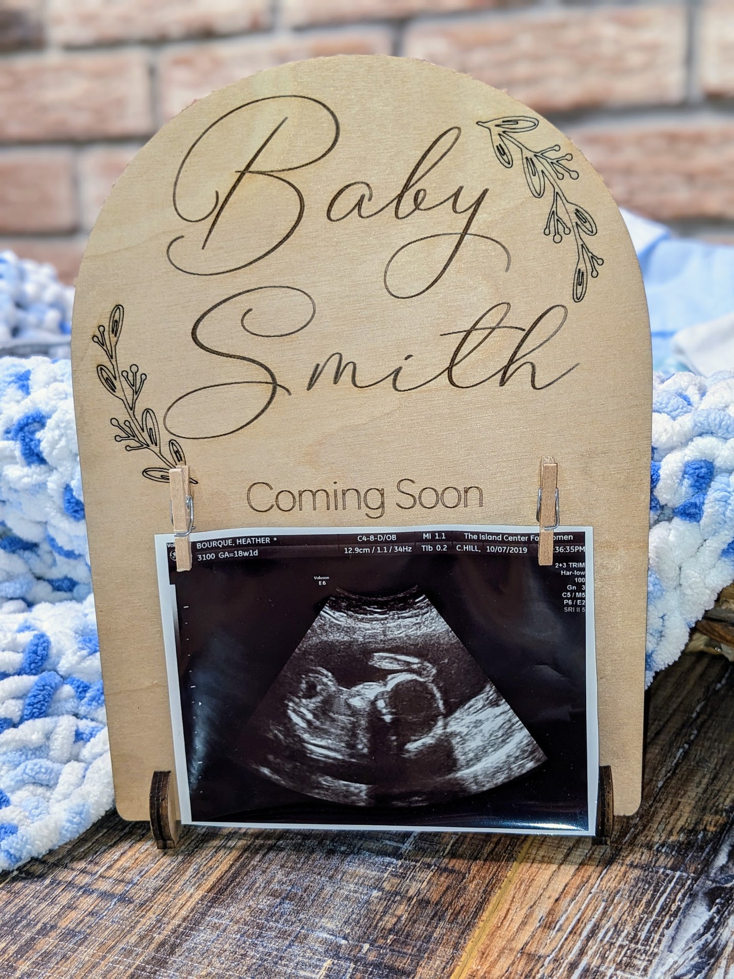 Ultrasound Sign